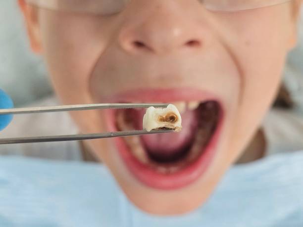 Best Emergency Treatment for Jaw Pain or Injury in Ingalls Park, IL
